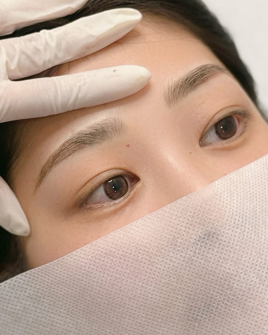ソウル新沙 毛並み眉アートメイク 施術結果